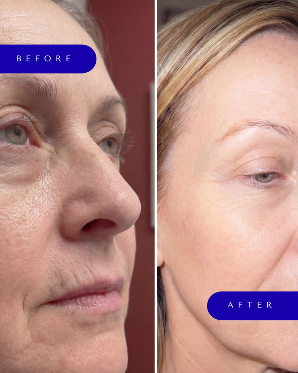 Regenerative+ Marine Collagen & Multivitamin Powder