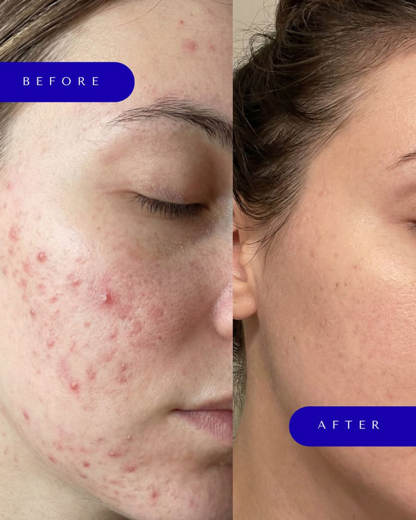Regenerative+ Marine Collagen & Multivitamin Powder